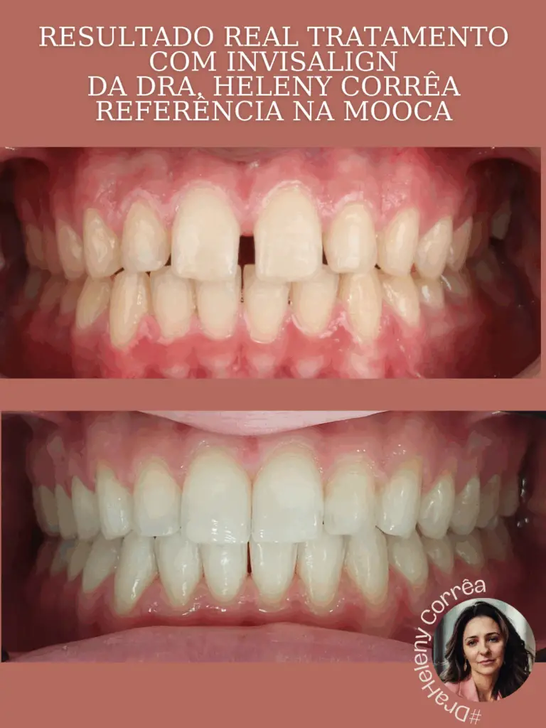 caso tratado pela dra Heleny Correa