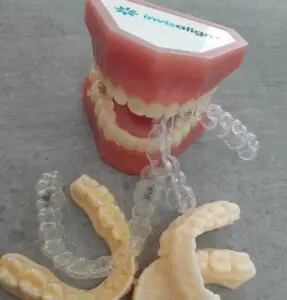 Invisalign