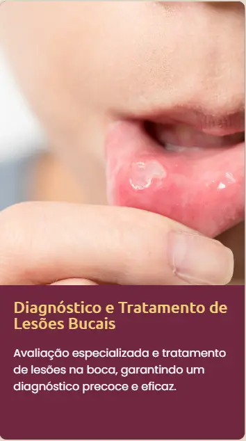 diagnostico e tratamento de lesoes bucais