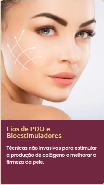 fios de pdo e bioestimuladores