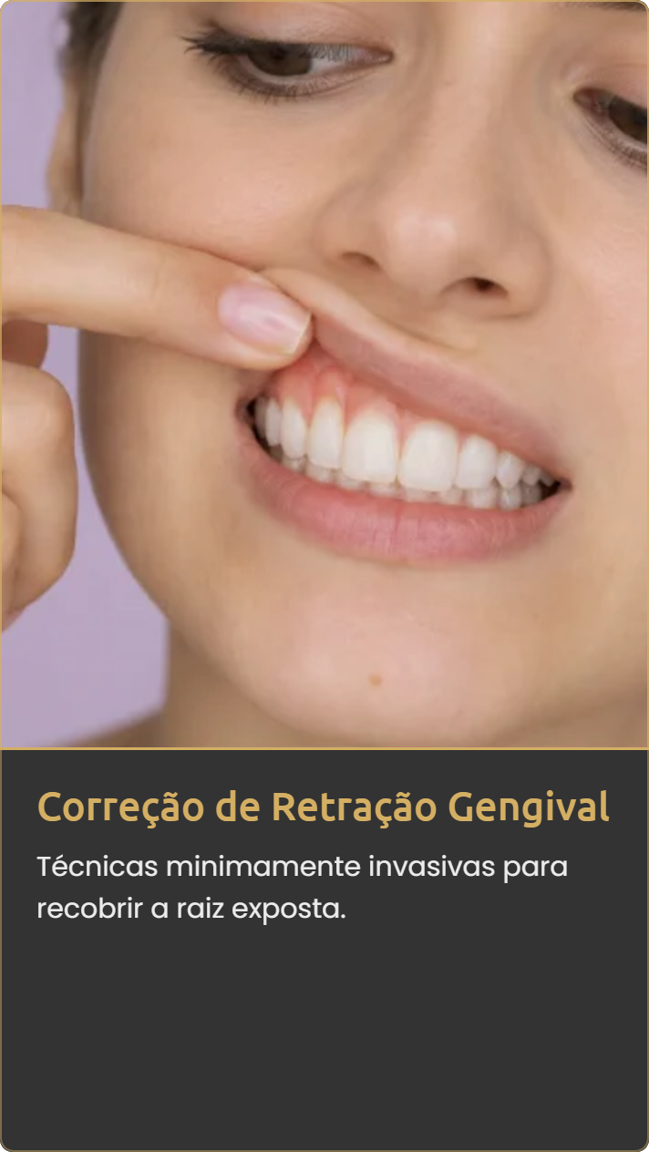 Correção de Retração Gengival na Mooca e Vila Olímpia – Clínica Dra. Heleny Corrêa
