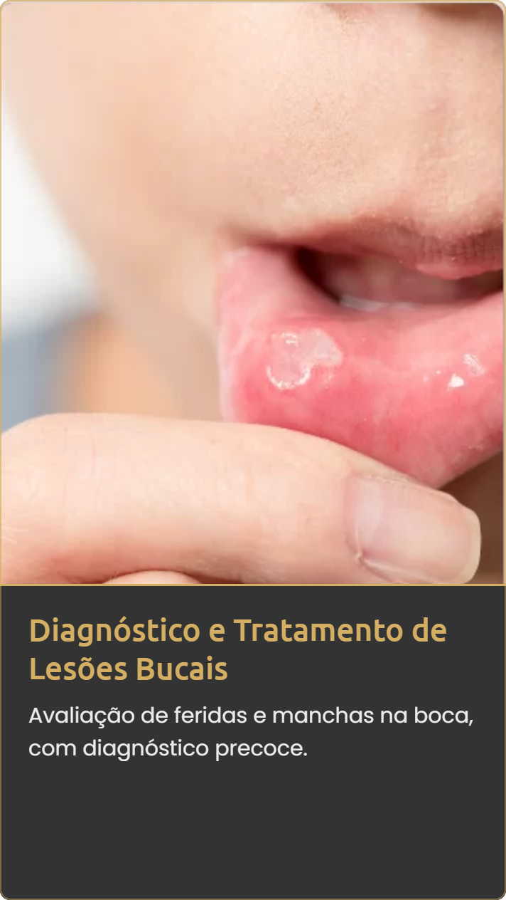 Diagnóstico e Tratamento de Lesões Bucais na Mooca e Vila Olímpia – Clínica Dra. Heleny Corrêa