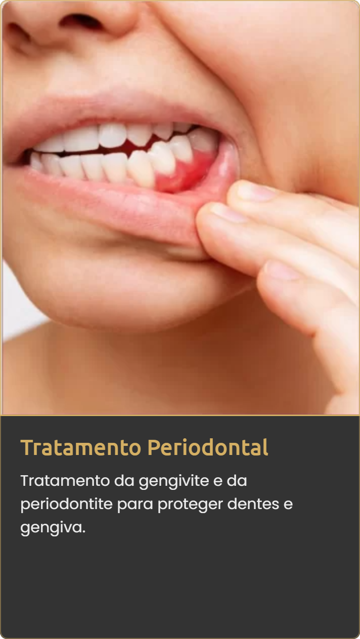 Tratamento Periodontal na Mooca e Vila Olímpia – Clínica Dra. Heleny Corrêa